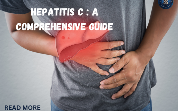 Hepatitis C : A Comprehensive Guide