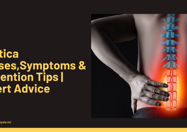 Sciatica |Causes,Symptoms & Prevention Tips | Expert Advice