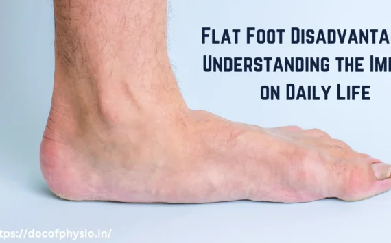 Flat Foot Disadvantages: Understanding the Impact on Daily Life