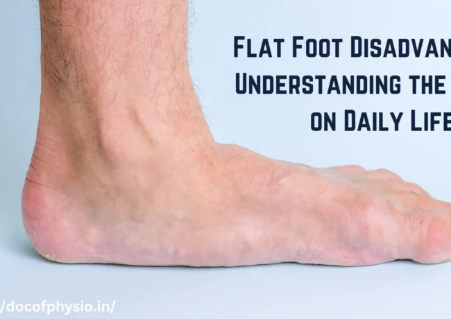 Flat Foot Disadvantages: Understanding the Impact on Daily Life